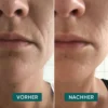 mouth pads HYALURON | Apricot