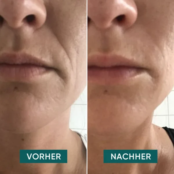 mouth pads HYALURON | Apricot