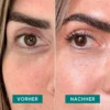 eye & temple pads HYALURON | Apricot