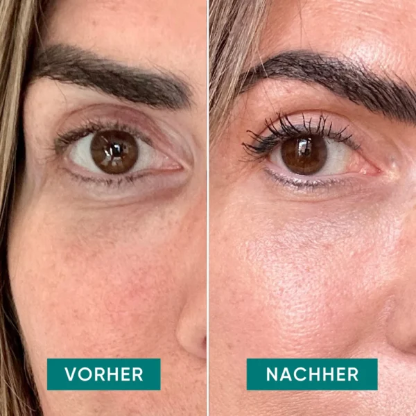 eye & temple pads HYALURON | Apricot