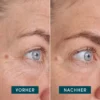 eye & temples pads ECTOÏNE | Apricot