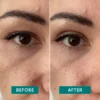 eyelid lifting tapes | Apricot