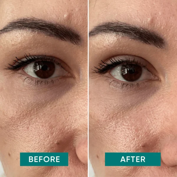 eyelid lifting tapes | Apricot