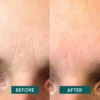 facial patches ECTOÏNE | Apricot