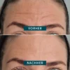 forehead pad ECTOÏNE | Apricot