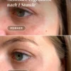 eye & temples pads HEXAPEPTIDE | Apricot