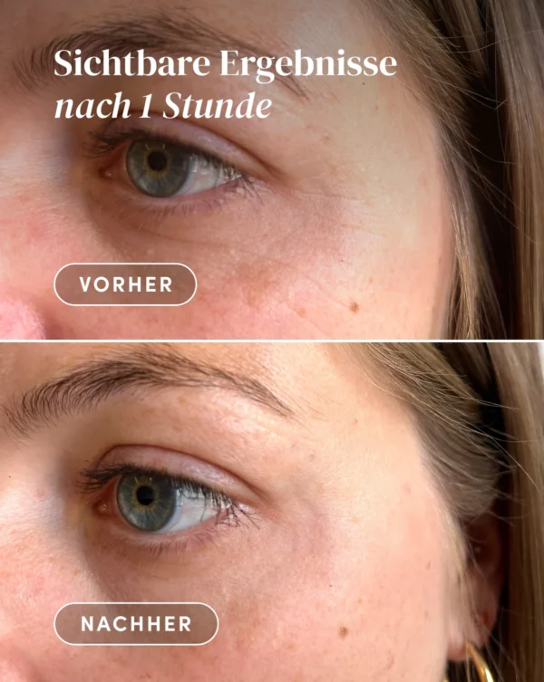 eye & temples pads HEXAPEPTIDE | Apricot