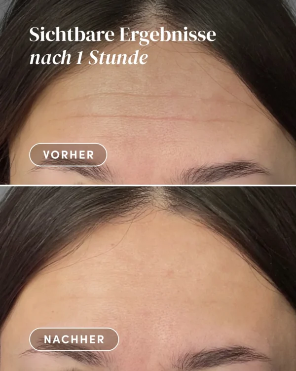 forehead pad HEXAPEPTIDE | Apricot