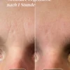 PHANTÉNOL2 facial patches PANTHÉNOL | Apricot
