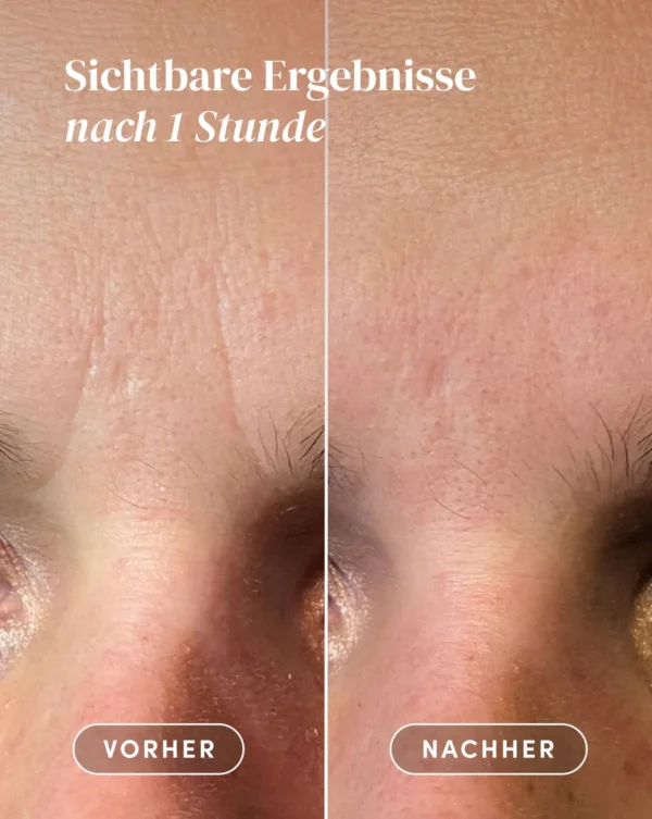 PHANTÉNOL2 facial patches PANTHÉNOL | Apricot