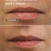 mouth patches2 mouth patches PANTHÉNOL | Apricot