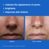 4-foaming_reset_mask_before_after_2_1_1 foaming Reset Mask 30 Ml | Malin + Goetz