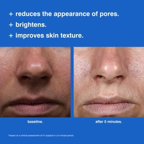 4-foaming_reset_mask_before_after_2_1_1 foaming Reset Mask 30 Ml | Malin + Goetz